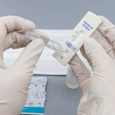 test antigénique image illustration